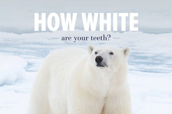How white are your teeth?